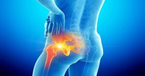 Kalçada Kireçlenme Belirtileri Kalçada Kireçlenme Belirtileri