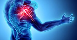 Omuz Sıkışması Sendromu Omuz Sıkışması Sendromu