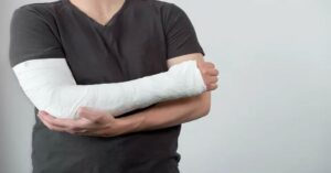 Üst Kol Kırığı Tedavisi Üst Kol Kırığı Tedavisi