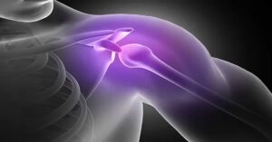 Omuz Artroskopi Ameliyatı Omuz Artroskopi Ameliyatı