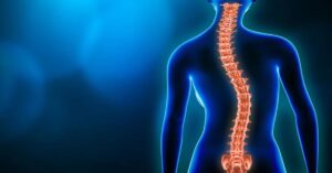 Omurga Kayması Tedavisi