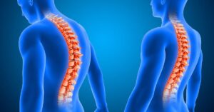 Omurga Kayması Tedavisi