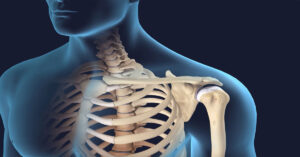 Omuz Fıtığı Ameliyatı Omuz Fıtığı Ameliyatı