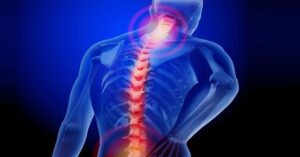 Boyun Fıtığı Nedir? Boyun Fıtığı Nedir?