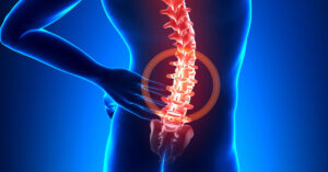 Omurga Kayması Ameliyatı Omurga Kayması Ameliyatı